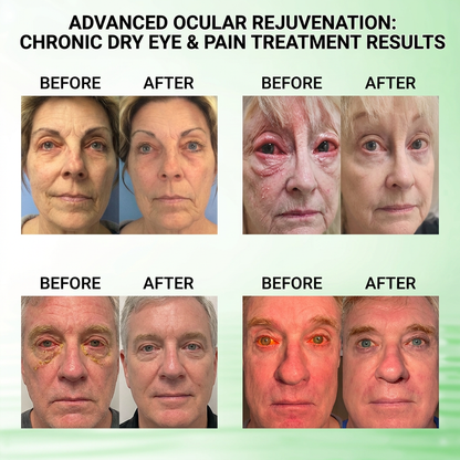 DOTALE® Presbyopia Mask-Quantum-Thermal Bio-Transdermal Optical Restoration System