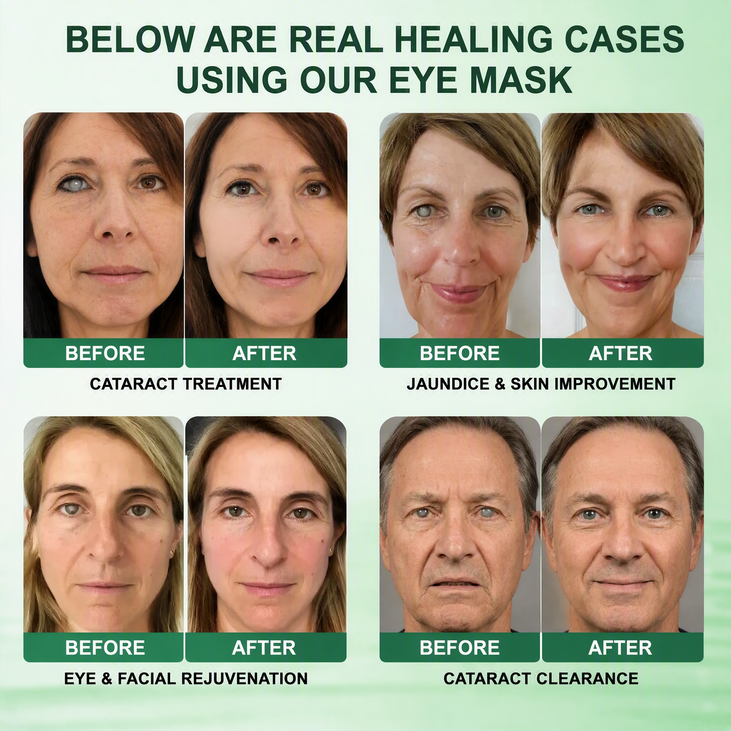 DOTALE® Presbyopia Mask-Quantum-Thermal Bio-Transdermal Optical Restoration System
