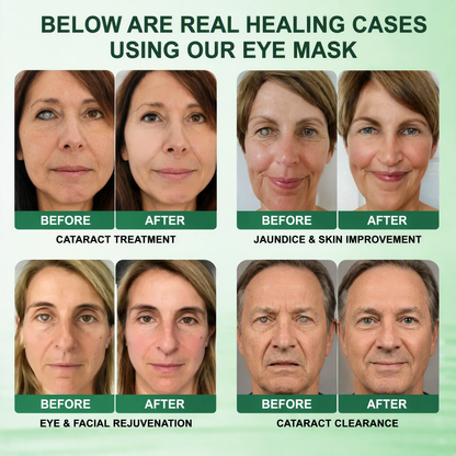 DOTALE® Presbyopia Mask-Quantum-Thermal Bio-Transdermal Optical Restoration System