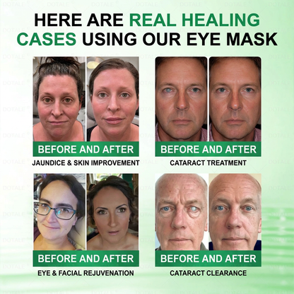 DOTALE® Presbyopia Mask-Quantum-Thermal Bio-Transdermal Optical Restoration System