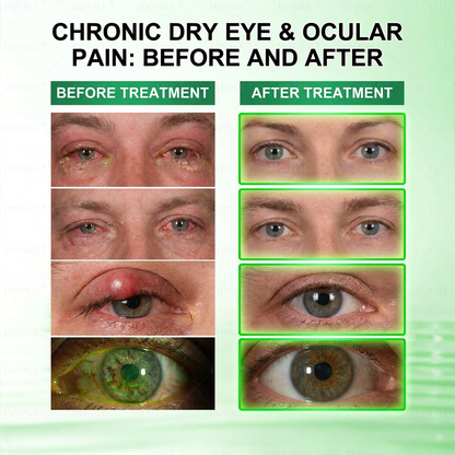 DOTALE® Presbyopia Mask-Quantum-Thermal Bio-Transdermal Optical Restoration System